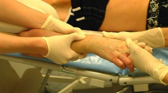 Radiusbrudd, reponering