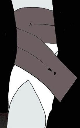 Albueteiping bilde#2