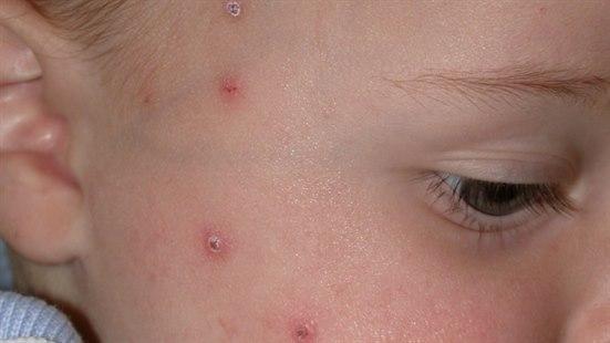 Bildequiz uke 44.jpg