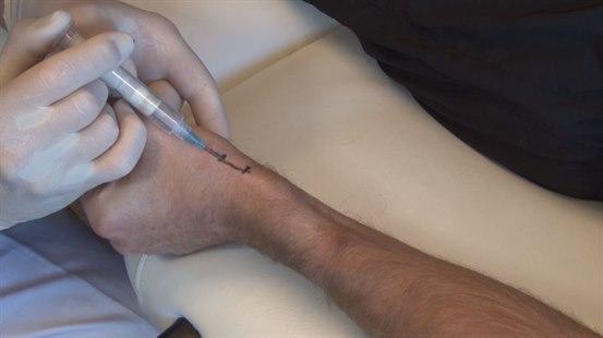 De Quervain's tenosynovitis