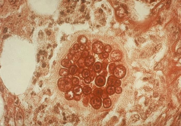 Coccidioides immitis. Fra Centers for Disease Control and Prevention, USA.