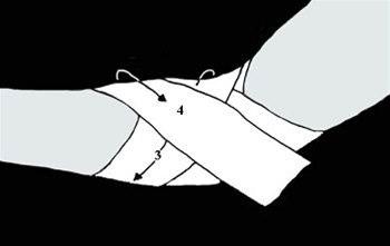 Albuestøtte bilde#3