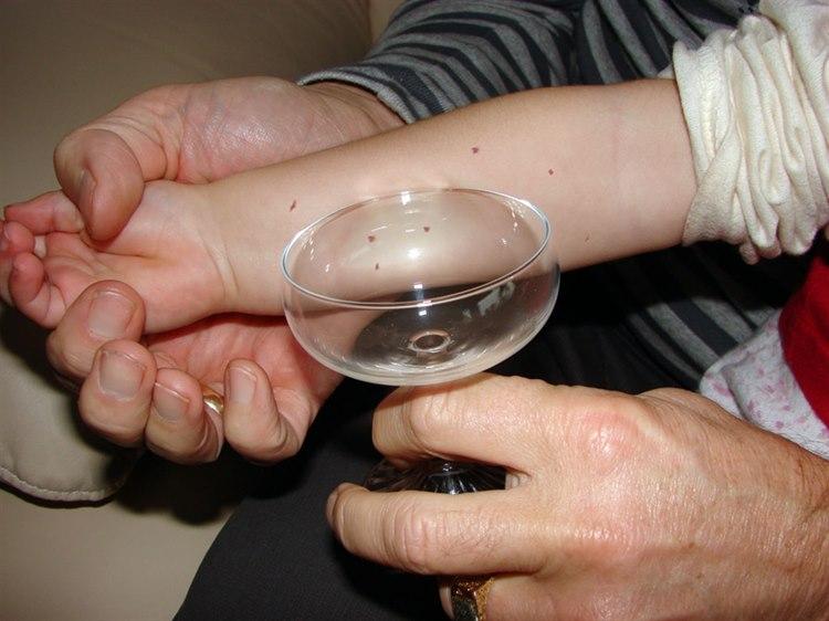 Petekkier, glasstest