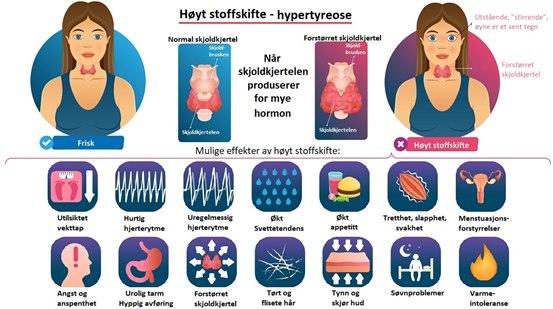 Viser visuelt ulike symptomer ved hypertyreose