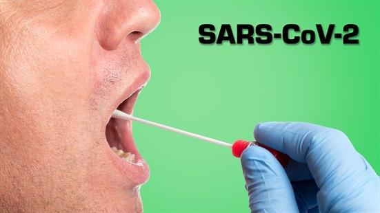SARS-CoV-2