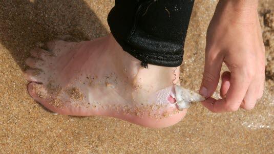 Illustrasjonsfoto av noen som river av et gnagsårplaster som er på hælen. Vi ser en liten del av gnagsåret.