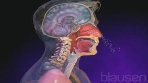 Øvre luftveisinfeksjon