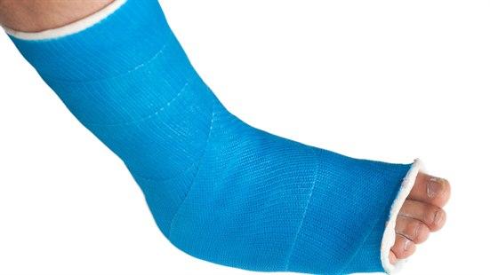 Illustrasjonsfotoet viser en fot som er gipset 