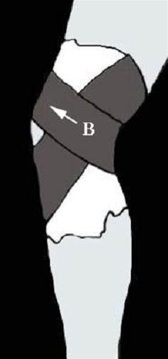 Kneleddsteiping bilde#5