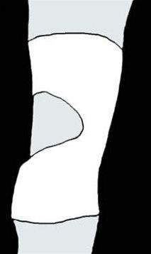 Kneleddsstøtte bilde#6