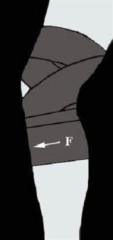 Kneleddsteiping bilde#9