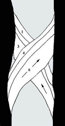 Albueteiping bilde#1