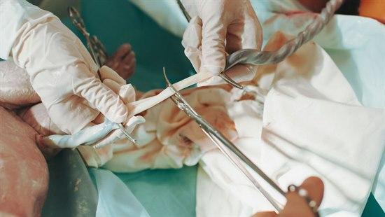 Navlesnor som er i ferd med å klippes over.