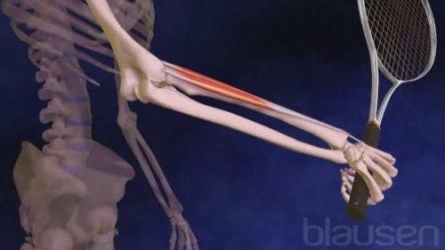 Illustrasjonsbilde av en tennisalbue