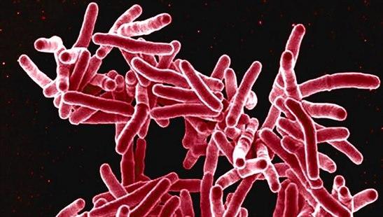 Mycobacterium tuberculosis