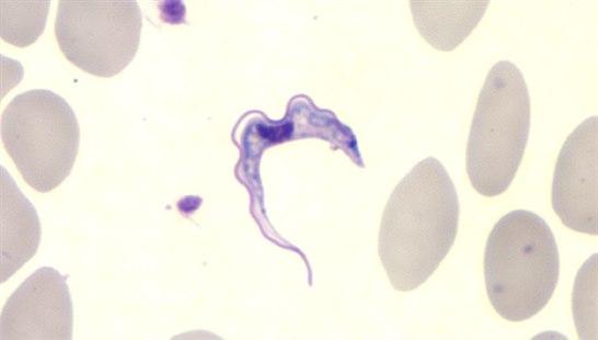 Trypanosomiasis