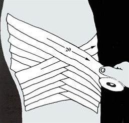 Ribbeinsteiping bilde#7