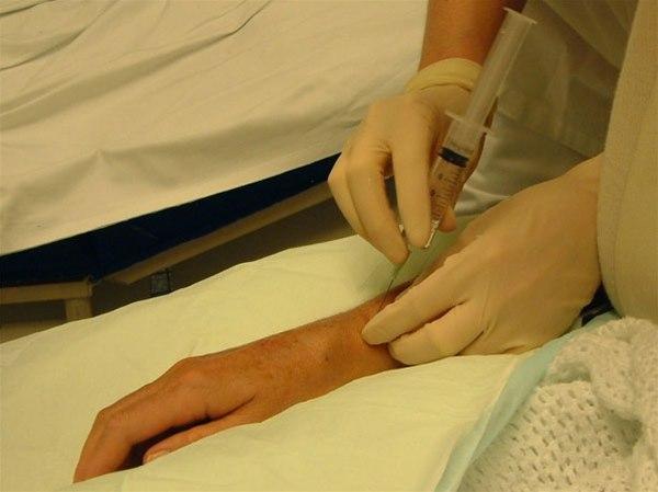 Radiusbrudd, anestesi