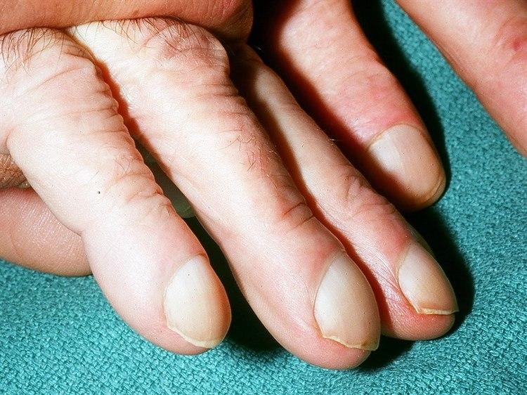 Fotoet viser nærbilde av trommestikkfingre