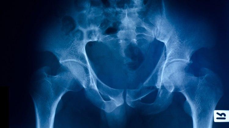 Bekkenet med hofteledd