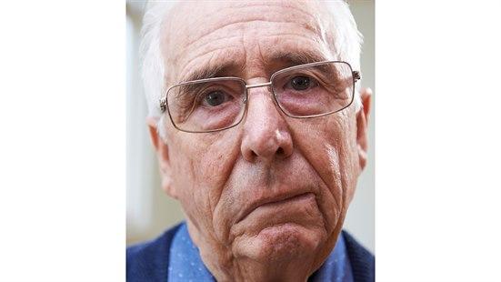 Illustrasjonsfotoet viser en eldre mann med skjevhet i ansiktet