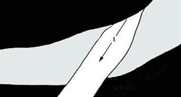 Albuestøtte bilde#1