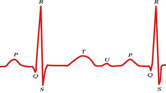 EKG