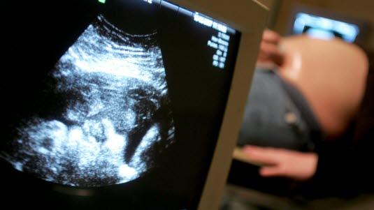 Fotoet viser en ultralydskjerm med bilde av foster og i bakgrunnen sees en gravid kvinne som ligger på en benk