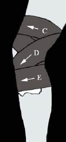 Kneleddsteiping bilde#8