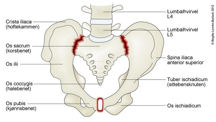Illustrasjon av Ileosakralleddene og symfysen (skambeinet) er markert med rødt