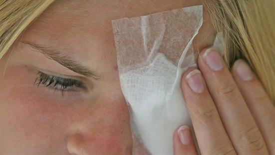 Nærbilde av et ansikt til en dame som har bandasje over et øye