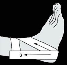 Ankelbandasjering bilde#2