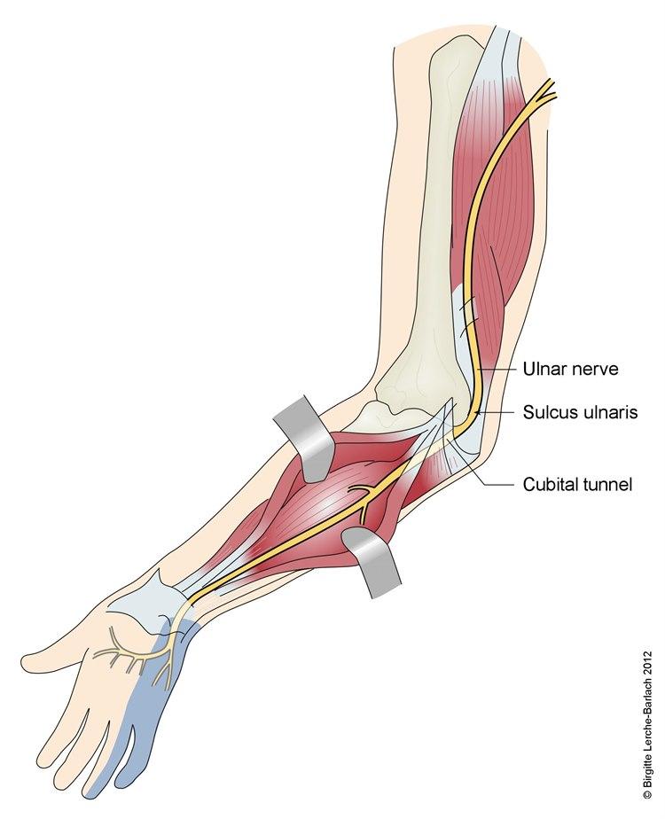 Nervus ulnaris