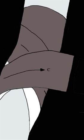 Albueteiping bilde#3