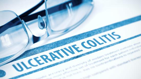 Ulcerøs kolitt
