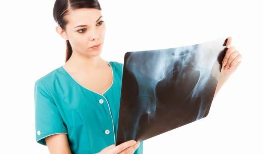 Illustrasjonsfotoet viser en kvinne som vurderer et røntgenbildet av bekkenet