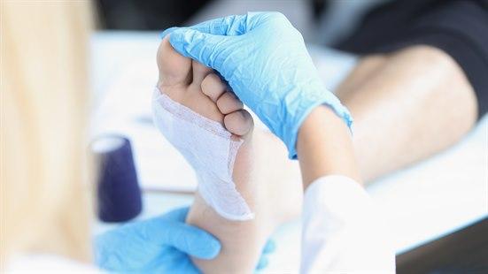 Illustrasjonsfotoet viser en fot som blir undersøkt. Foten har en plastret skade i fotbladet