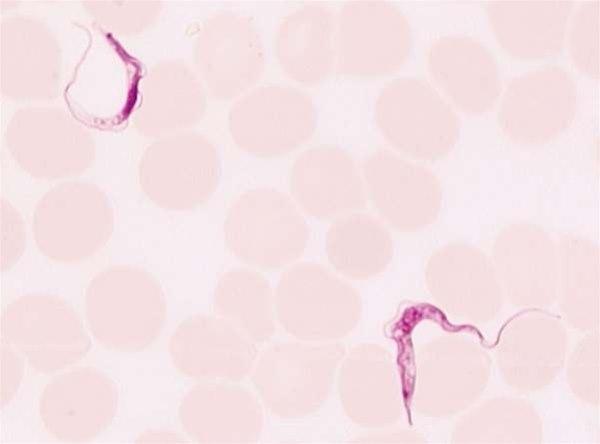 Trypanosoma parasitt. Blodutstryk fra en pasient med Trypanosomiasis brucei rhodesiense
