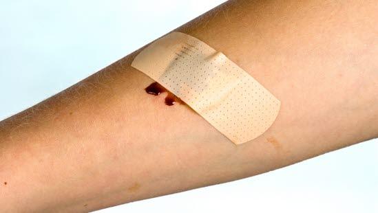 Plastret over et blodig sår 