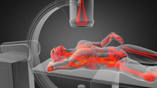 Røntgen av skjelettet