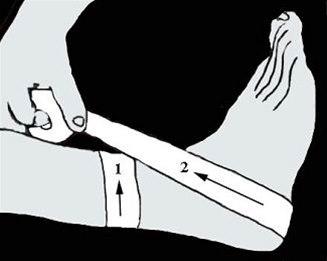 Ankelbandasjering bilde#1