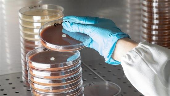 Stabler av petriskåler med soppkolonier.