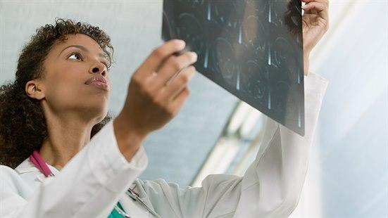 Illustrasjonsfoto: Kvinne i hvit frakk og med stetoskop rundt halsen holder opp og ser på et MR-bilde.