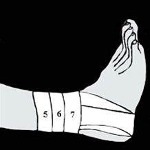 Ankelbandasjering bilde#4