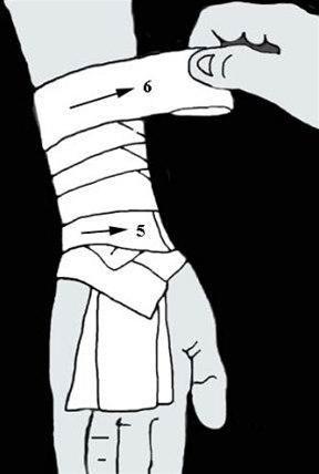 Håndleddsstøtte 1 bilde#3