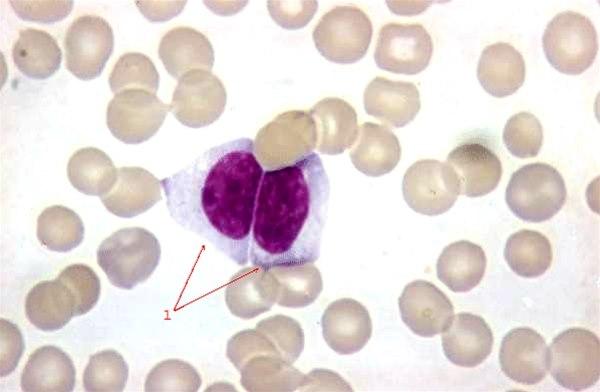 Fotoet viser mononukleose, McKinlay celler