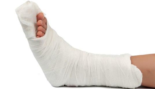 Illustrasjonsfoto av en ankel med både gips og støttebandasje