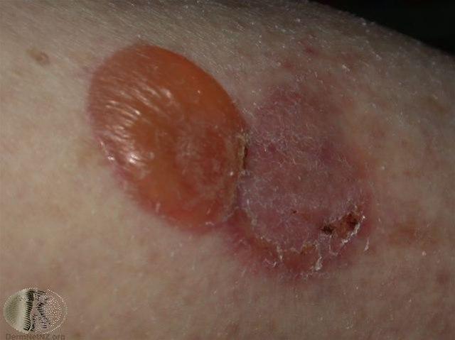 Fotoet viser nærbilde av Ppmfigoid