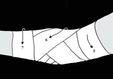 Albuestøtte bilde#5