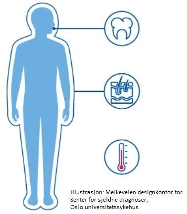 Ektodermale dysplasier